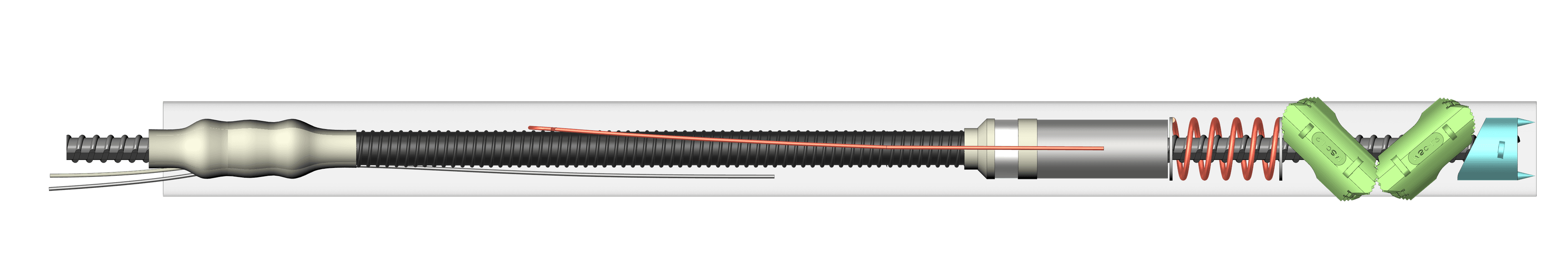고정핀 제거 - 정착체 끼임